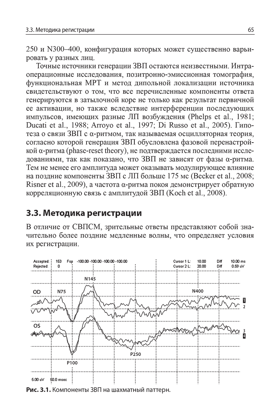 Рис. 3.1. Компоненты ЗВП на шахматный паттерн.