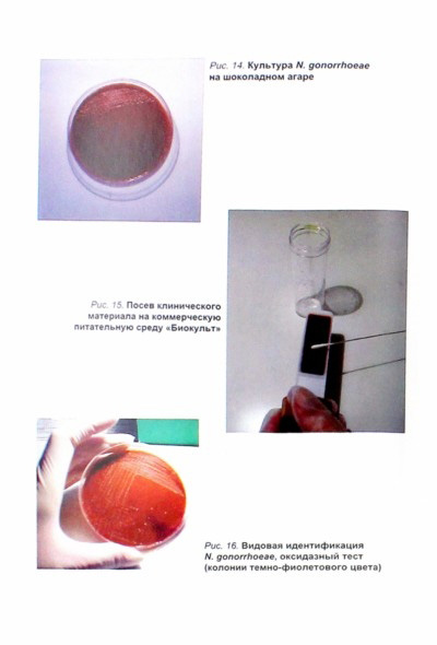Пример страниц из книги "Гонококковая инфекция. Ведение больных. Рекомендации для врачей" - Е. В. Соколовского