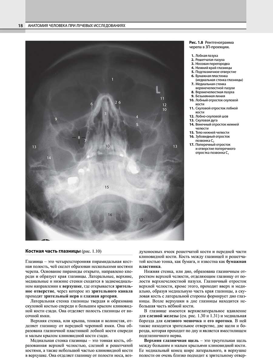 Рис. 1.8 Рентгенограмма черепа в ЗП-проекции.