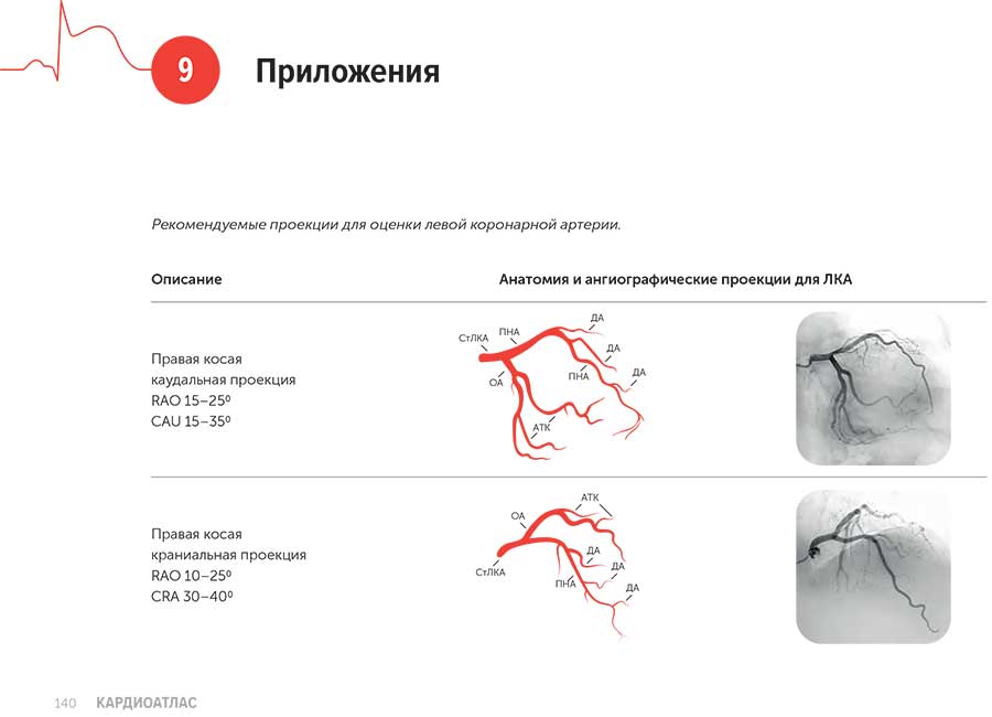 Рекомендуемые проекции для оценки левой коронарной артерии.