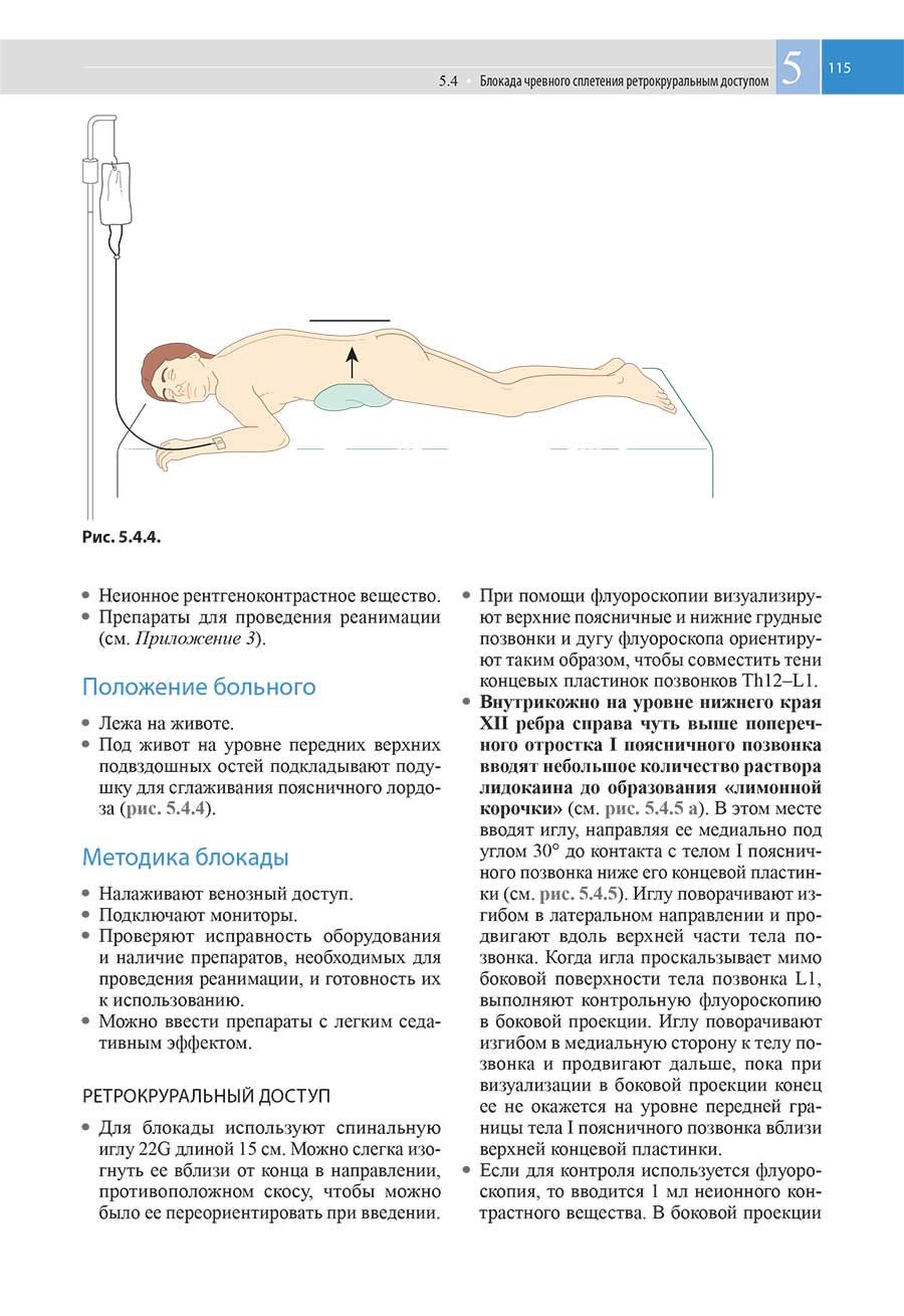 Пример страницы из книги "Атлас по инъекционным методам лечения боли"