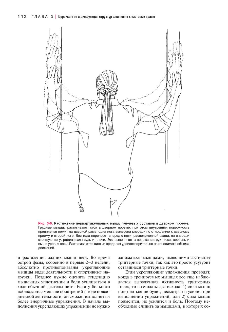 Рис. 3-6. Растяжение периартикулярных мышц плечевых суставов в дверном проеме.