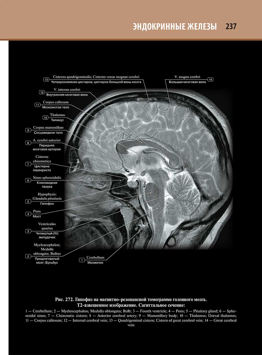Гипофиз на магнитно-резонансной томограмме головного мозга.
