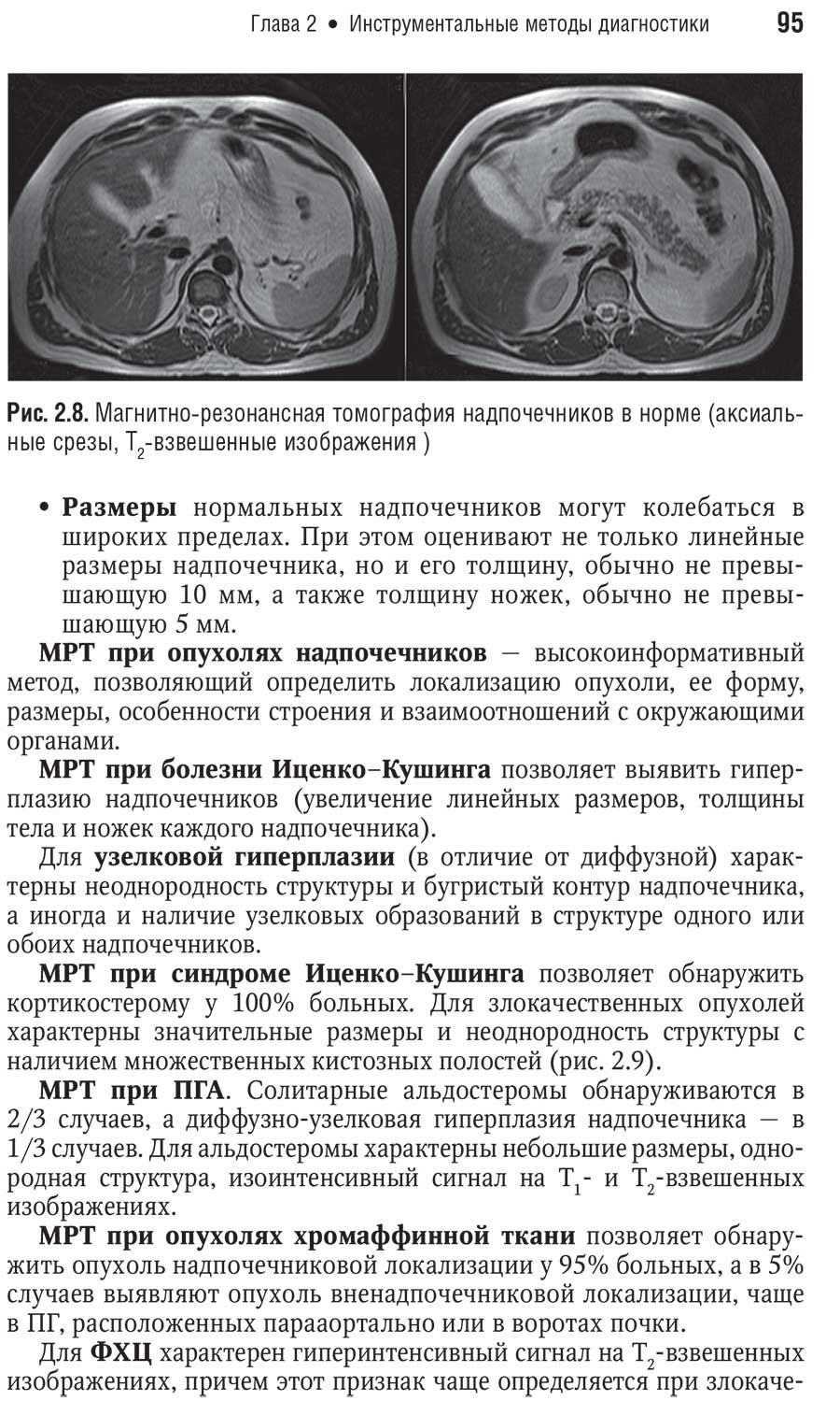Рис. 2.8. Магнитно-резонансная томография надпочечников в норме