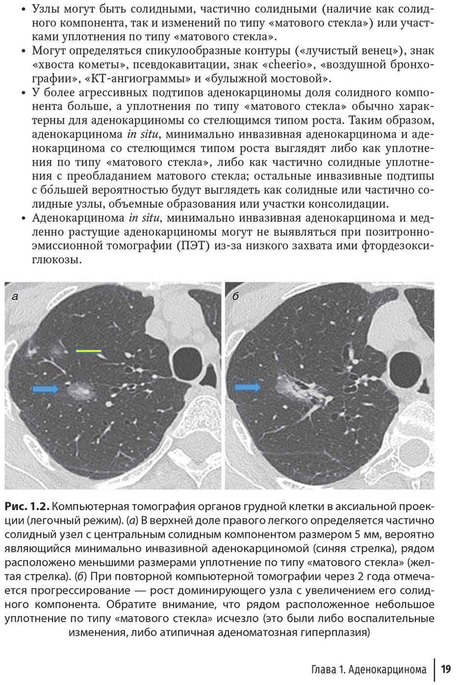 Рис. 1.2. Компьютерная томография органов грудной клетки
