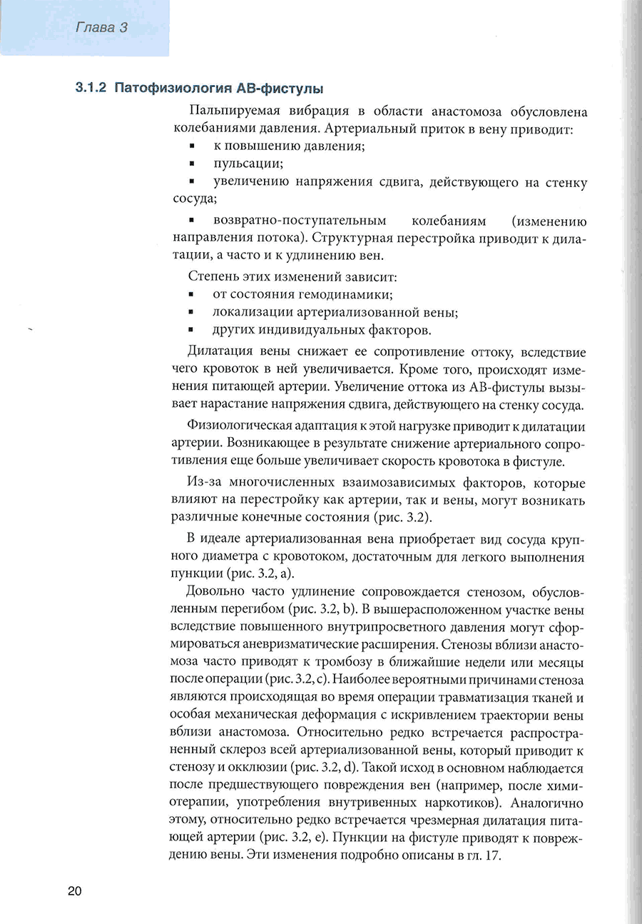 Пример страницы из книги "Хирургия сосудистого доступа для гемодиализа" - Х. Шольц
