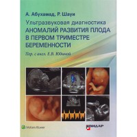 Ультразвуковая диагностика аномалий развития плода в первом триместре беременности - Абухамад А., Шауи Р.