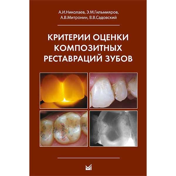 Критерии оценки композитных реставраций зубов - Николаев А. И.