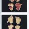 Пример страницы из книги "Морфология опухолей сердца. Атлас." - Л. А. Бокерия, Р. А. Серов, В. Э. Кавсадзе