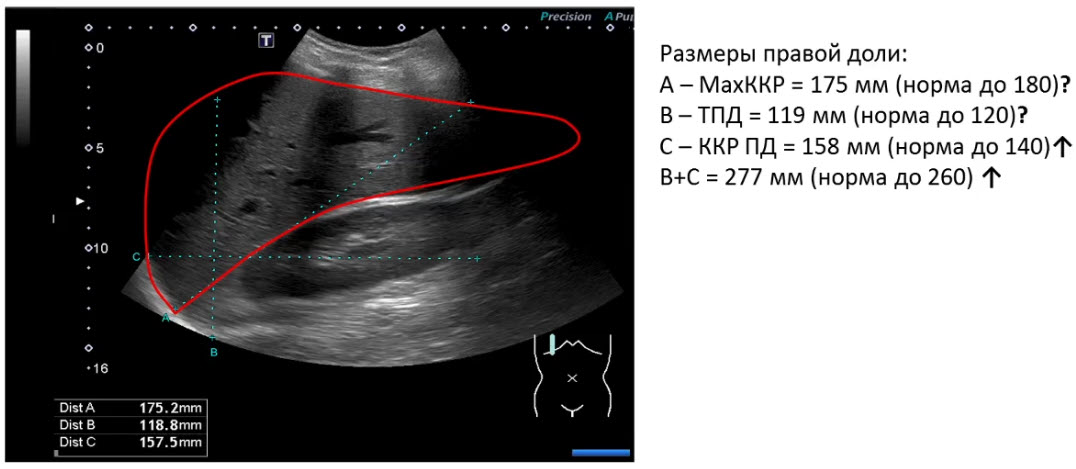 Техника измерения МахККР, ТПД, ККРПД