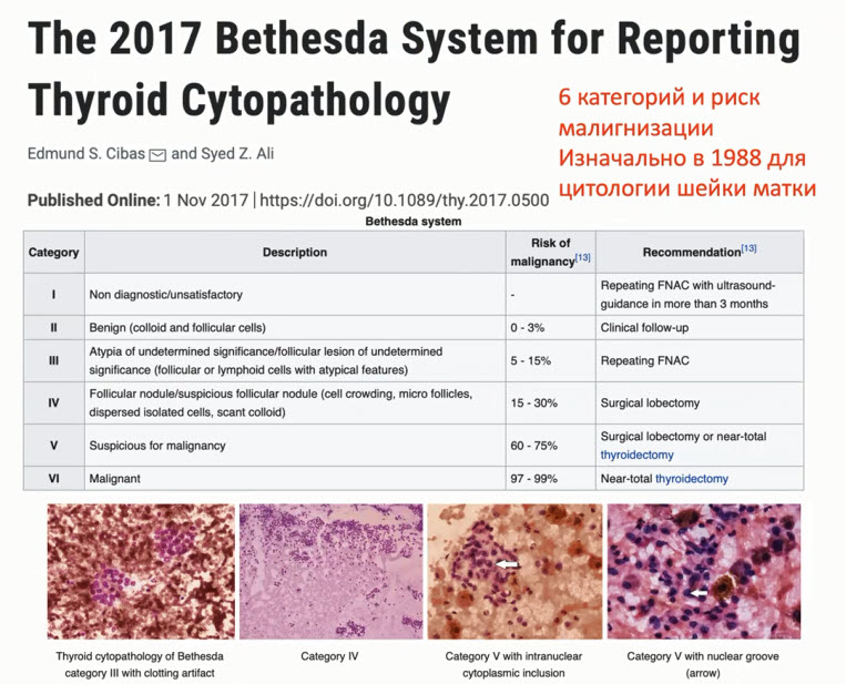  Система Bethesda для отчета по тиреоидной цитопатологии
