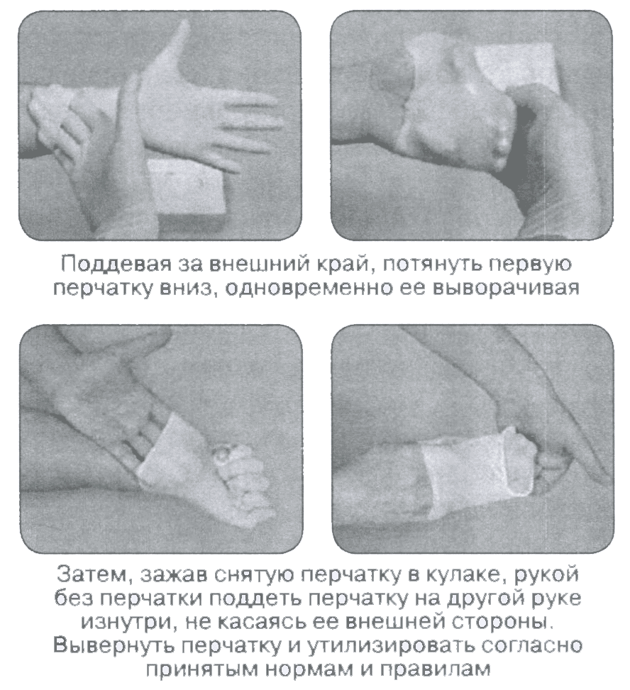 Техника снятия медицинских перчаток Техника снятия медицинских перчаток