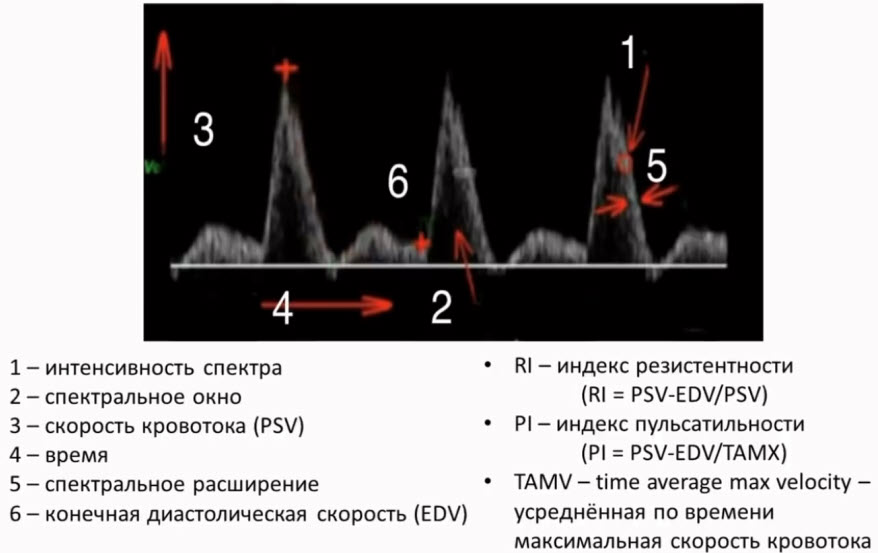 Артериальный допплеровский спектр