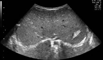 Здоровый ребенок 6 мес. Сканирование в эпигастрии.