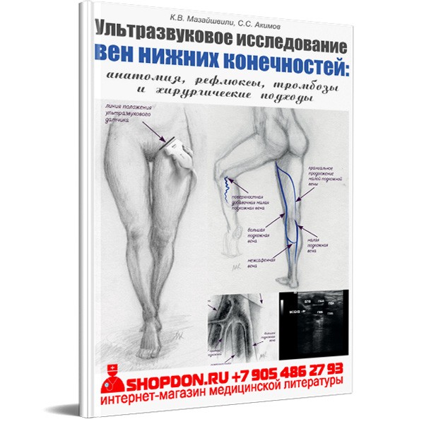 Книга "Ультразвуковое исследование вен нижних конечностей: анатомия, рефлюксы, тромбозы и хирургические подходы" - К. В. Мазайшвили