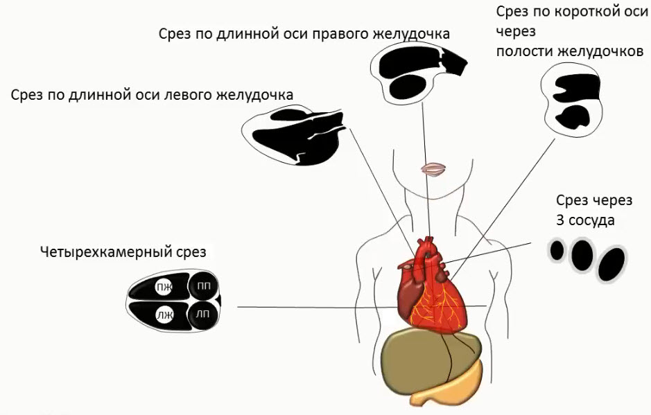 Схематическое изображение плоскости сканирования при эхокардиографическом исследовании сердца плода