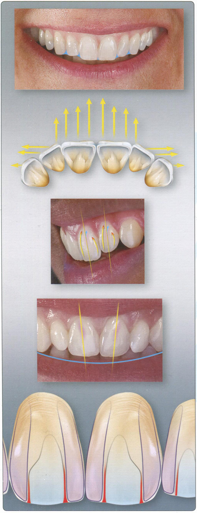 Десять компонентов естественной улыбки: эстетика передних зубов