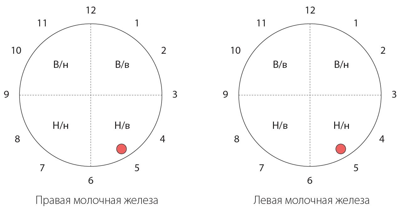 Приложение 1 Схема обозначения квадрантов молочной железы и секторов по принципу циферблата часов