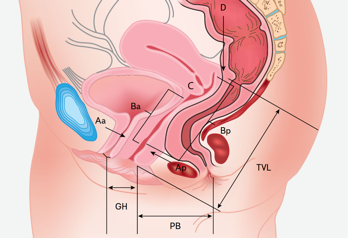 Рис. 1. Анатомические ориентиры для определения степени пролапса тазовых органов.