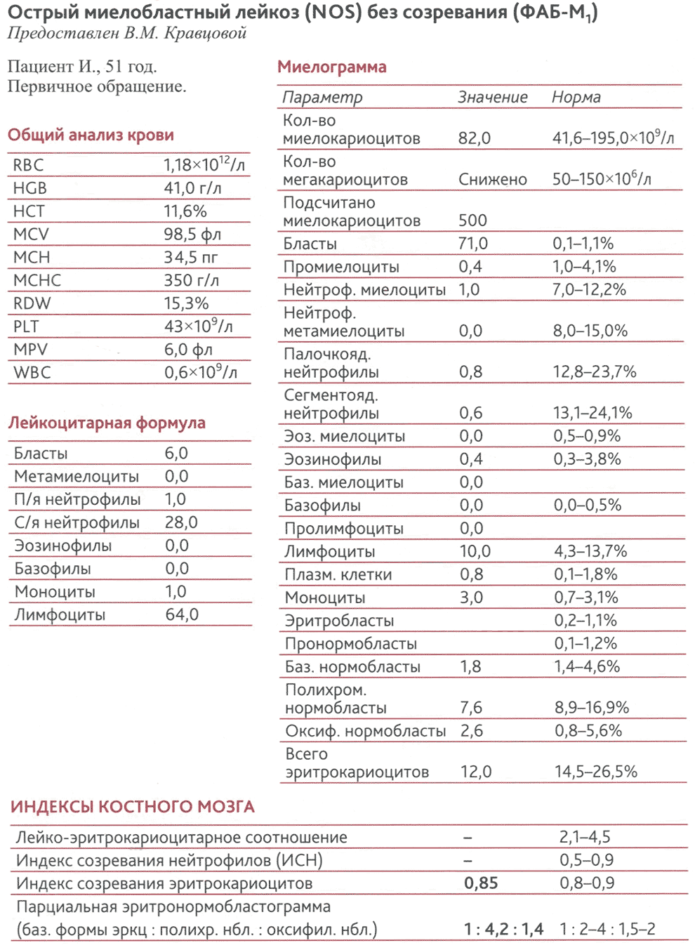 Острый миелобластный лейкоз (NOS) без созревания 