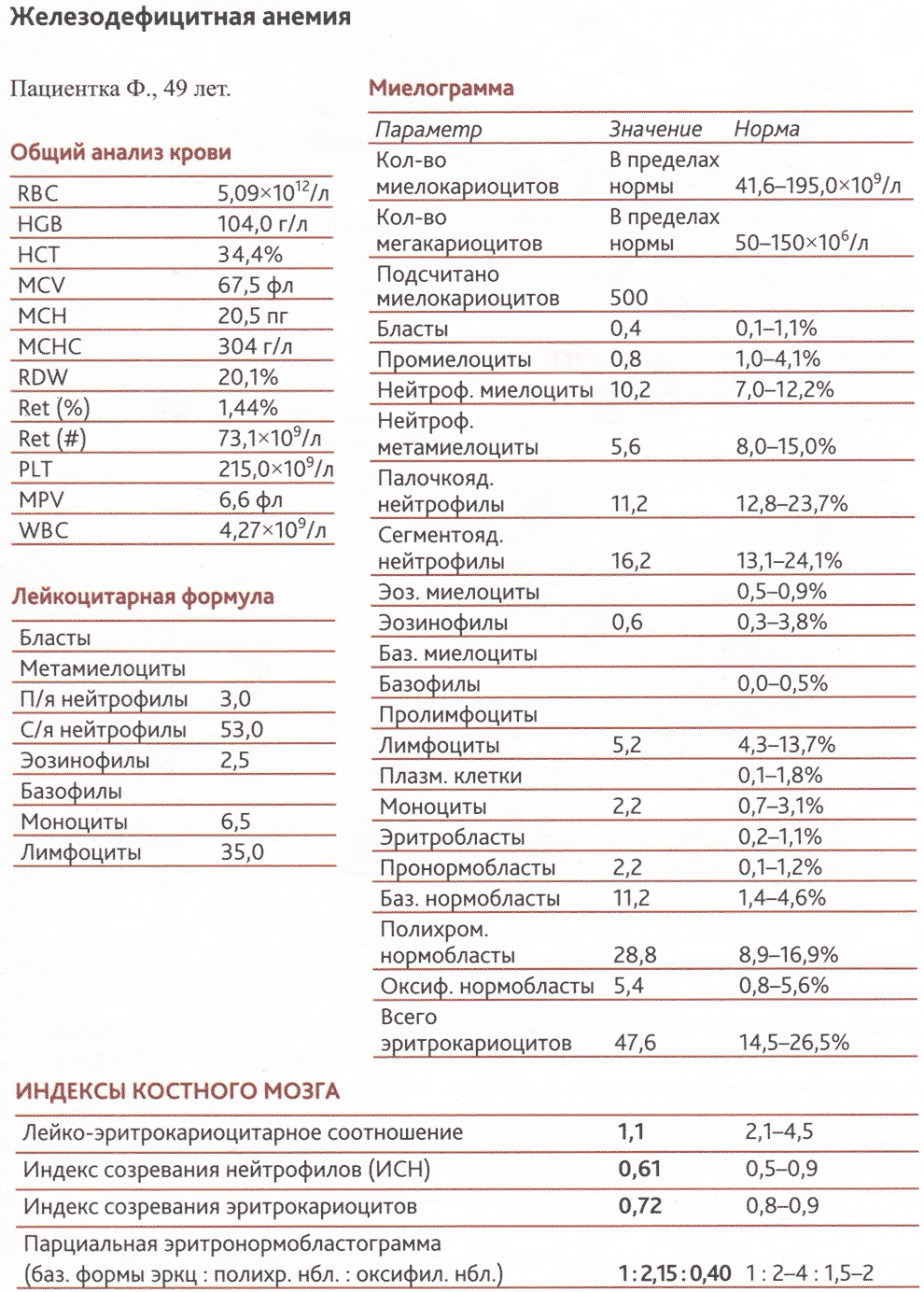 Железодефицитная анемия