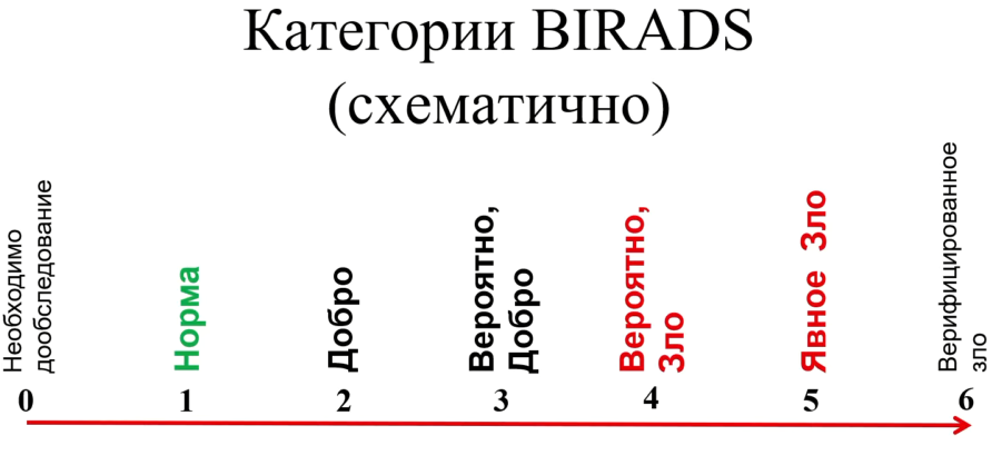 Категории BI-RADS (схематично)
