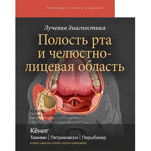 Купить книгу "Лучевая диагностика. Полость рта и челюстно-лицевая область" - Кениг Лиза Дж. в интернет-магазине медицинской книги shopdon.ru