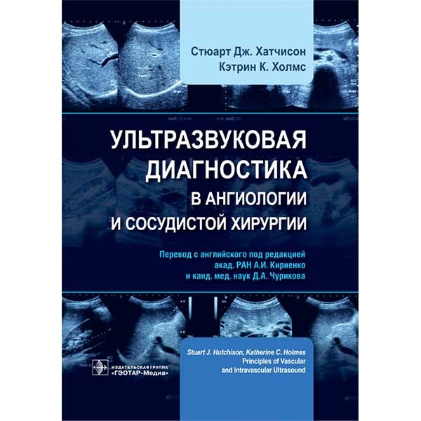 Купить книгу "Ультразвуковая диагностика в ангиологии и сосудистой хирургии" - Хатчисон С. Дж., Холмс К. К.