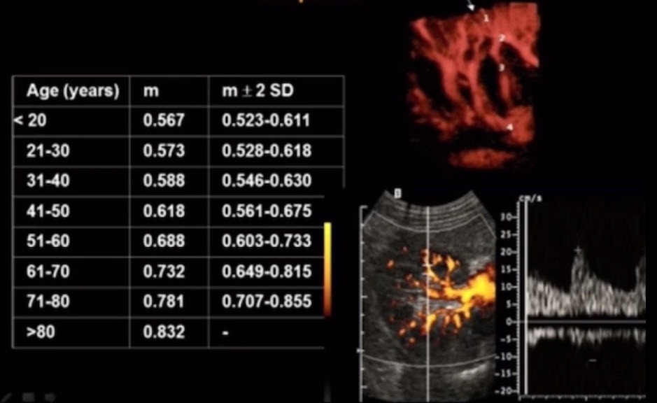 Индекс периферической резистентности у здоровых лиц в сегментарных почечных артериях в зависимости от возраста 