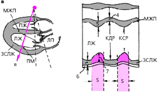 Схема основных структур в PLAX М LV