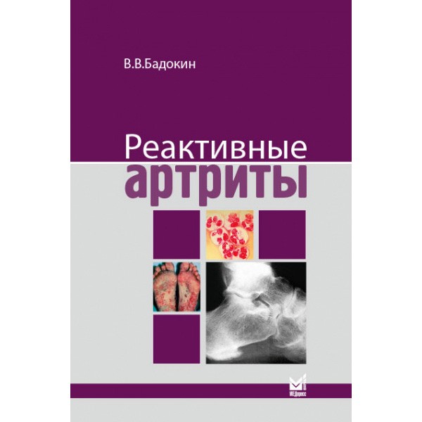 Купить книгу "Реактивные артриты. Урогенитальные и постэнтероколитические" - Бадокин В. В. в интернет-магазине медицинской книги shopdon.ru Купить книгу "Реактивные артриты. Урогенитальные и постэнтероколитические" - Бадокин В. В. в интернет-магазине медицинской книги shopdon.ru