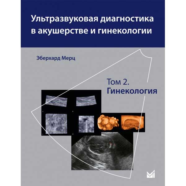 Купить книгу "Ультразвуковая диагностика в акушерстве и гинекологии: в 2 томах. Том 2. Гинекология" - Мерц Эберхард