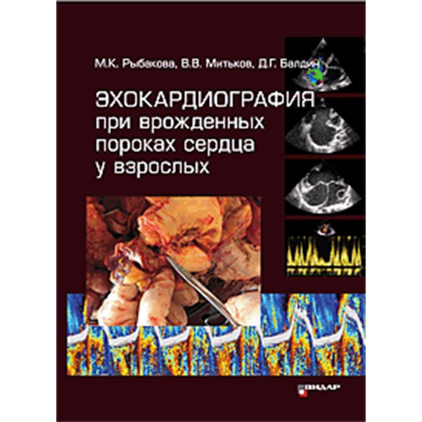 Купить книгу "Эхокардиография при врожденных пороках сердца у взрослых" в интернет-магазине shopdon.ru