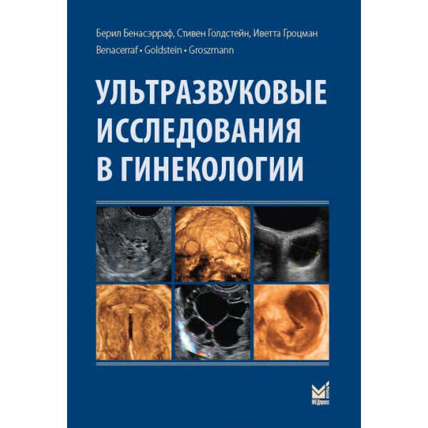 Купить книгу «Ультразвуковые исследования в гинекологии» &mdash; Берил Бенасэрраф, Стивен Голдстейн, Иветта Гроцман в интернет-магазине медицинской литературы shopdon.ru