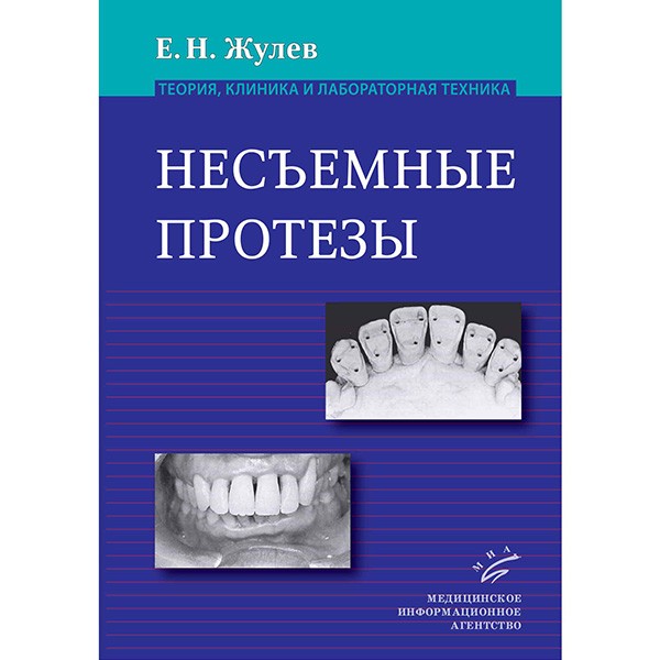 Купить книгу "Несъемные протезы: теория, клиника и лабораторная техника" - Жулев Е. Н.