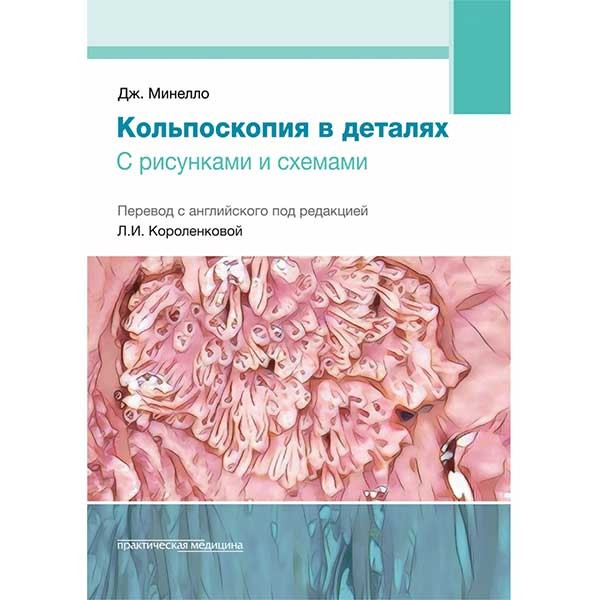 Купить книгу "Кольпоскопия в деталях. С рисунками и схемами" - Минелло Дж. в интернет-магазине медицинской литературы shopdon.ru