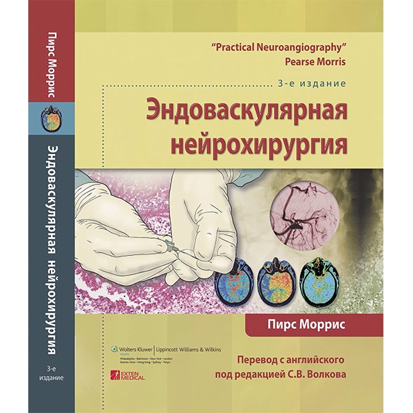 Купить книгу "Эндоваскулярная нейрохирургия" - Пирс Моррис в интернет-магазине медицинской литературы shopdon.ru. Доставка медицинской литературы по России и всему миру