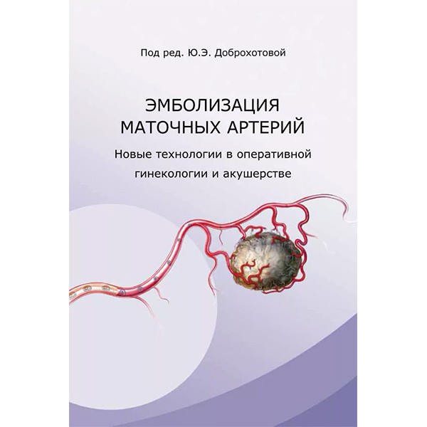 Купить книгу "Эмболизация маточных артерий" (отрывок из книги "Эмболизация маточных артерий" - Ю. Э. Доброхотова)