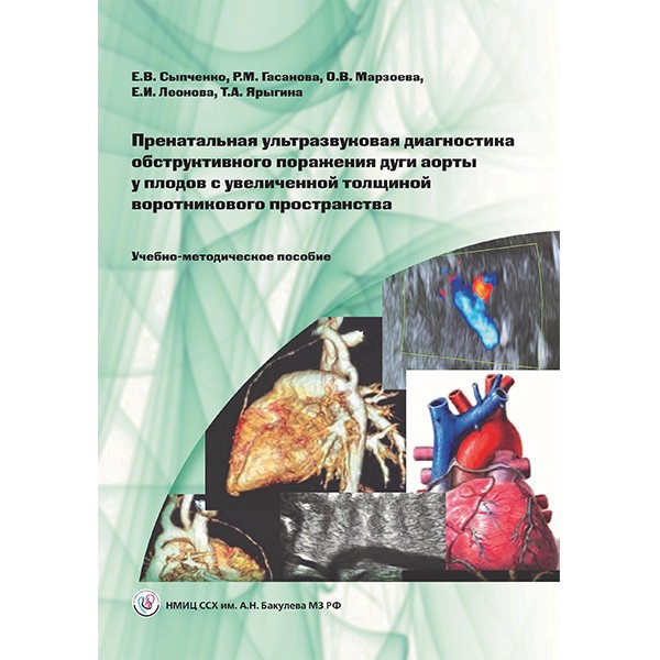 Купить книгу "Пренатальная ультразвуковая диагностика обструктивного поражения дуги аорты у плодов с увеличенной толщиной воротникового пространства. Учебно-методическое пособие" - Сыпченко Е. В., Гасанова Р. М., Марзоева О. В., Леонова Е. И., Ярыгина Т. А. в магазине медицинской книги shopdon.ru