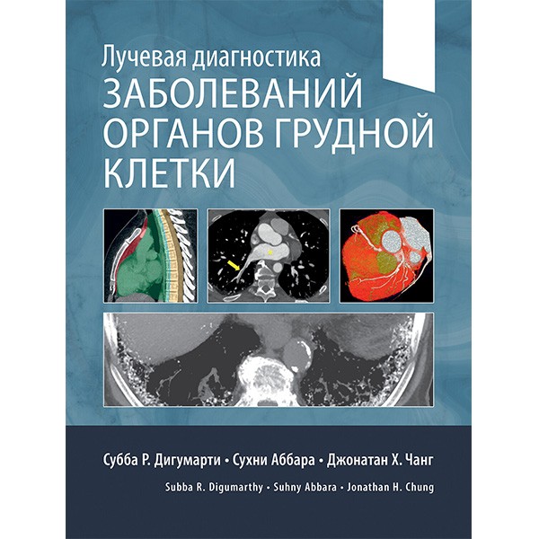 Купить книгу "Лучевая диагностика заболеваний органов грудной клетки" - С. Р. Дигумарти
