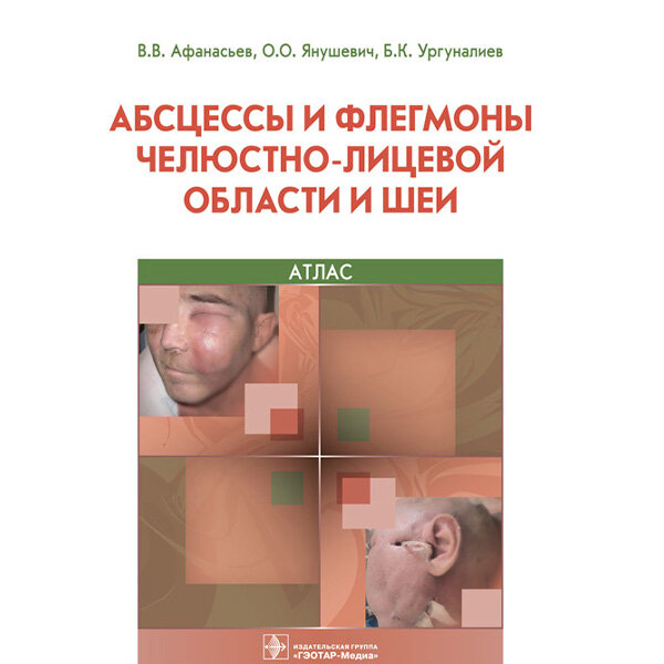 Купить книгу "Абсцессы и флегмоны челюстно-лицевой области и шеи. Атлас: учебное пособие" - Афанасьев В. В.