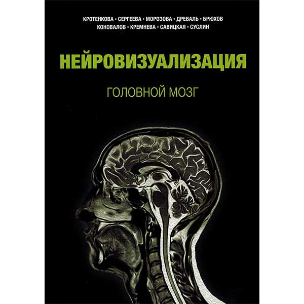 Купить книгу "Нейровизуализация. Головной мозг" - Кротенкова М. В., Сергеева А. Н., Морозова С. Н., Древаль М. В.