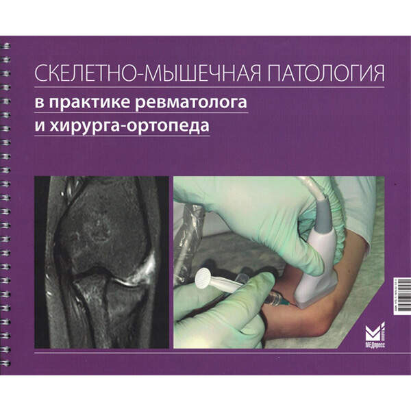 Купить книгу "Скелетно-мышечная патология в практике ревматолога и хирурга-ортопеда" - Лила А. М.