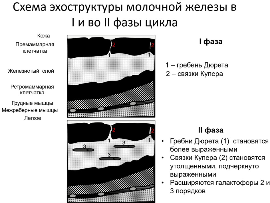 Схема эхоструктуры молочной железы в I и во II фазы цикла