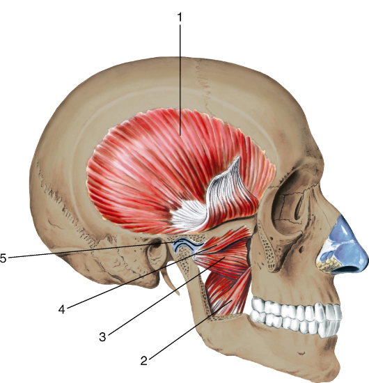  Крыловидные мышцы, вид с латеральной стороны (височная мышца отвернута; часть ветви нижней челюсти отпилена)