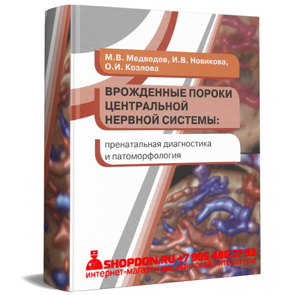 Купить книгу "Врожденные пороки центральной нервной системы: пренатальная диагностика и патоморфология" – М. В. Медведев, И. В. Новикова, О. И. Козлова в интернет-магазине shopdon.ru Купить книгу "Врожденные пороки центральной нервной системы: пренатальная диагностика и патоморфология" – М. В. Медведев, И. В. Новикова, О. И. Козлова в интернет-магазине shopdon.ru