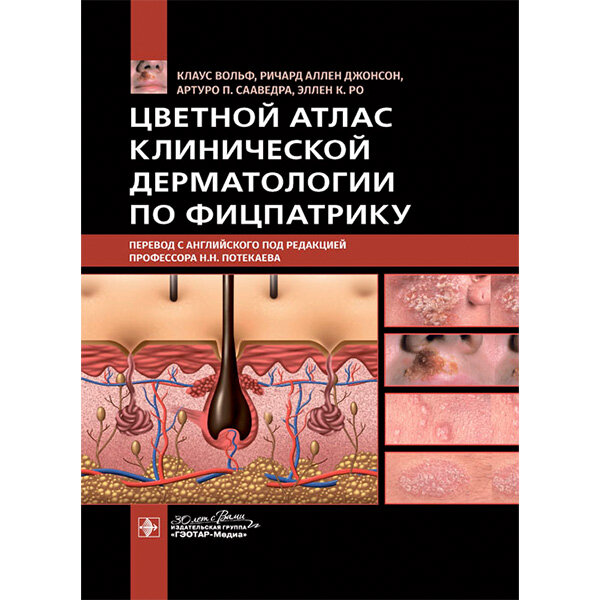 Купить книгу "Цветной атлас клинической дерматологии по Фицпатрику" - К. Вольф, Р. А. Джонсон, Артуро П. Сааведра, Эллен К. в интернет-магазине медицинской книги shopdon.ru