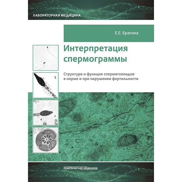 Купить книгу "Интерпретация спермограммы. Структура и функция сперматозоидов в норме и при нарушении фертильности" - Брагина Е. Е.