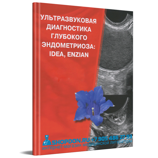 Купить книгу "Ультразвуковая диагностика глубокого эндометриоза: IDEA, ENZIAN" - М. В. Медведев, Н. А. Алтынник