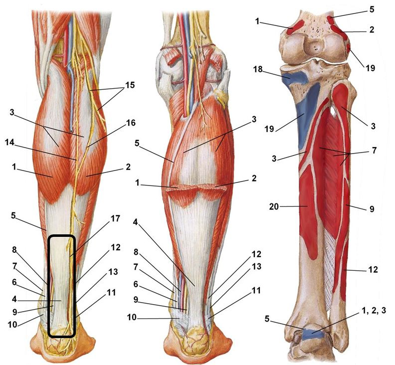 Область ахиллова сухожилия - схема А – вид сзади, Б – вид сзади, продолжение (резецирована икроножная мышца)